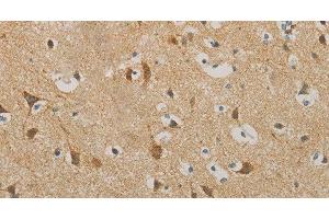 Immunohistochemistry of paraffin-embedded Human brain using IDH3G Polyclonal Antibody at dilution of 1:30 (IDH3G antibody)