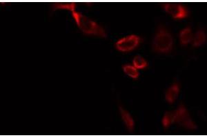 ABIN6274878 staining A549 by IF/ICC. (ATP5L2 antibody  (C-Term))