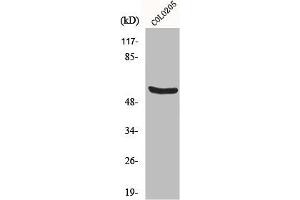 Western Blot analysis of COLO205 cells using HSP60 Polyclonal Antibody (HSPD1 antibody  (C-Term))
