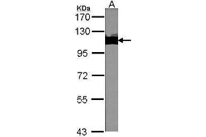 Western Blotting (WB) image for anti-Tripartite Motif Containing 28 (TRIM28) antibody (ABIN2855331)
