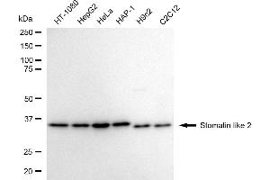 Western blotting analysis using Stomatin like 2 antibody (ABIN7800442).