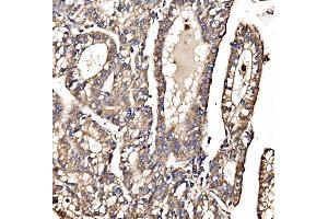 IHC analysis of MPPB/PMPCB using anti-MPPB/PMPCB antibody (ABIN7600758).