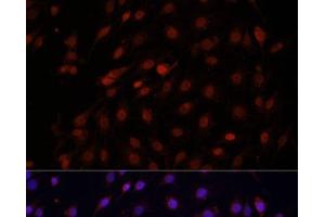 Immunofluorescence analysis of C6 cells using Bcl-2 Polyclonal Antibody at dilution of 1:100 (40x lens). (Bcl-2 antibody)