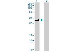 Western Blot analysis of MAGEA9 expression in transfected 293T cell line by MAGEA9 MaxPab polyclonal antibody. (MAGEA9 antibody  (AA 1-315))