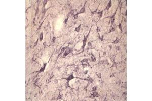 IHC on rat spinal cord using Rabbit antibody to extracellular, N-terminal part of Sortilin (Neurotensin receptor 3, NTR3, Sort1): IgG (ABIN350868) at a concentration of 10 µg/ml. (Sortilin 1 antibody)