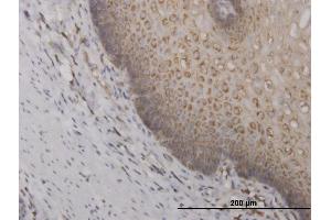 Immunoperoxidase of monoclonal antibody to RPS2 on formalin-fixed paraffin-embedded human esophagus. (RPS2 antibody  (AA 198-293))