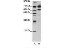 Image no. 1 for anti-Adenosine Deaminase, RNA-Specific, B1 (ADARB1) (AA 40-89) antibody (ABIN203245) (RED1 antibody  (AA 40-89))