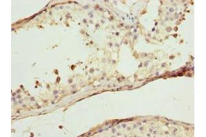 Immunohistochemistry of paraffin-embedded human testis tissue using ABIN7175708 at dilution of 1:100 (WIPI2 antibody  (AA 205-454))