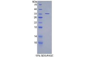 SDS-PAGE (SDS) image for Suppressor of Variegation 4-20 Homolog 2 (SUV420H2) (AA 2-279) protein (His tag) (ABIN1080877)