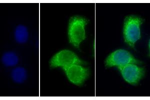 Detection of PDHb in Human Hela cell using Polyclonal Antibody to Pyruvate Dehydrogenase Beta (PDHb) (PDHB antibody  (AA 31-341))