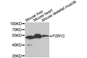 Western blot analysis of extracts of various cell lines, using P2RY2 antibody. (P2RY2 antibody  (AA 278-377))