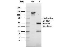 SDS-PAGE Analysis Purified AKT1 Recombinant Mouse Monoclonal Antibody (rAKT1/2491). (Recombinant AKT1 antibody  (AA 85-189))