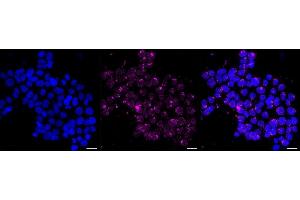 anti-Ribonuclease (RNASE) antibody