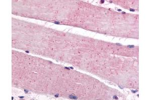 Anti-BEST3 antibody IHC of human skeletal muscle. (Bestrophin 3 antibody  (C-Term))