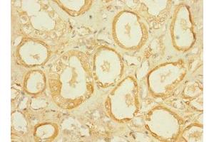 Immunohistochemistry of paraffin-embedded human kidney tissue using ABIN7170015 at dilution of 1:100 (SLC5A2 antibody  (AA 335-422))