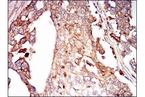 Syndecan 1 antibody  (AA 28-171)