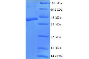 SDS-PAGE (SDS) image for Dickkopf 2 Homolog (DKK2) (AA 34-259) protein (His-SUMO Tag) (ABIN5711797)