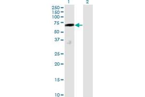 Western Blot analysis of DCP1A expression in transfected 293T cell line by DCP1A monoclonal antibody (M01), clone 2D12. (DCP1A antibody  (AA 186-285))