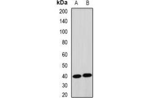 Western blot analysis of TERE1 expression in mouse liver (A), rat heart (B) whole cell lysates. (UBIAD1 antibody)