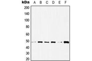 Western blot analysis of Histone Deacetylase 3 expression in HeLa (A), C32 (B), NIH3T3 (C), Raw264. (HDAC3 antibody  (C-Term))