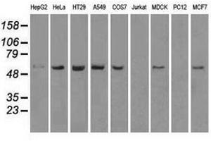 Image no. 6 for anti-Transmembrane Protein 100 (TMEM100) antibody (ABIN1501422) (TMEM100 antibody)