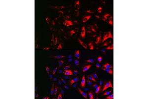 Immunofluorescence analysis of U2OS cells using RRM2 Rabbit pAb (ABIN6129715, ABIN6147265, ABIN6147266 and ABIN6220890) at dilution of 1:150 (40x lens). (RRM2 antibody  (AA 1-389))