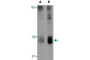 Western blot analysis of WNT10B in human skeletal muscle tissue lysate with WNT10B polyclonal antibody  at (A) 2 and (B) 4 ug/mL . (WNT10B antibody  (Internal Region))
