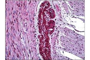 Human Colon, Ganglion: Formalin-Fixed, Paraffin-Embedded (FFPE) (MAP3K7 antibody  (Internal Region))