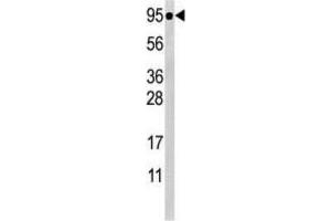 Western Blotting (WB) image for anti-Signal Transducer and Activator of Transcription 5A (STAT5A) (pSer726) antibody (ABIN5021402) (STAT5A antibody  (pSer726))
