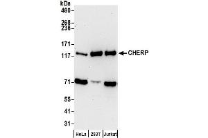 anti-Calcium Homeostasis Endoplasmic Reticulum Protein (CHERP) (AA 866-916) antibody