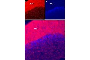 Immunohistochemistry (IHC) image for anti-Sodium Channel, Voltage-Gated, Type I, alpha Subunit (SCN1A) (AA 465-481), (Intracellular) antibody (Atto 594) (ABIN7043639)