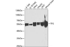 Western blot analysis of extracts of various cell lines using TFG Polyclonal Antibody at dilution of 1:1000. (TFG antibody)