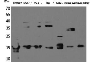 Western Blotting (WB) image for anti-MK (Internal Region) antibody (ABIN5956379) (MK (Internal Region) antibody)