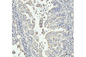 IHC analysis of MOV10 using anti-MOV10 antibody (ABIN7600236). (MOV10 antibody  (AA 167-772))