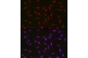 Immunofluorescence analysis of U2OS cells using RBM14 Rabbit pAb (ABIN6133649, ABIN6146760, ABIN6146762 and ABIN6217049) at dilution of 1:350 (40x lens). (RBM14 antibody  (AA 500-600))