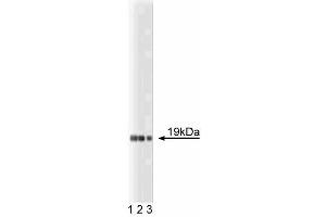 Western blot analysis of Telethonin of mouse heart lysate. (TCAP antibody  (AA 1-167))