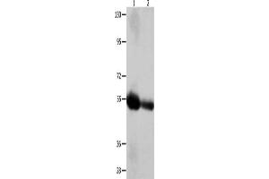 Gel: 10 % SDS-PAGE, Lysate: 60 μg, Lane 1-2: Human liver cancer tissue, Human bladder carcinoma tissue, Primary antibody: ABIN7128892(CEACAM1 Antibody) at dilution 1/400, Secondary antibody: Goat anti rabbit IgG at 1/8000 dilution, Exposure time: 2 minutes (CEACAM1 antibody)