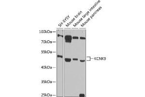 Western blot analysis of extracts of various cell lines, using KCNK9 antibody (ABIN6128568, ABIN6142756, ABIN6142758 and ABIN6216267) at 1:1000 dilution. (KCNK9 antibody  (AA 265-374))