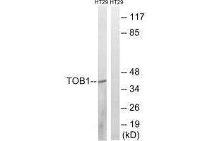 Western blot analysis of extracts from HT-29 cells, treated with serum (20 % , 15 mins), using TOB1 (Ab-164) antibody. (Protein Tob1 (TOB1) (Ser164) antibody)