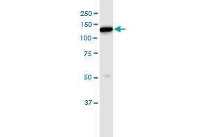 Immunoprecipitation of HK1 transfected lysate using anti-HK1 MaxPab rabbit polyclonal antibody and Protein A Magnetic Bead , and immunoblotted with HK1 purified MaxPab mouse polyclonal antibody (B01P) . (Hexokinase 1 antibody  (AA 1-916))