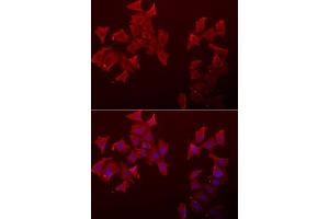 Immunofluorescence analysis of A549 cells using LECT1 antibody (ABIN5973998).