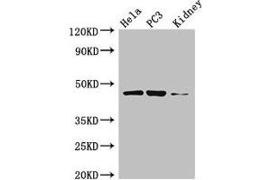 Western Blot Positive WB detected in: Hela whole cell lysate, PC-3 whole cell lysate, Mouse kidney tissue All lanes: GSK3B antibody at 3 μg/mL Secondary Goat polyclonal to rabbit IgG at 1/50000 dilution Predicted band size: 47, 49 kDa Observed band size: 47 kDa (GSK3 beta antibody  (AA 1-420))