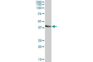 ASCC1 MaxPab polyclonal antibody. (ASCC1 antibody  (AA 1-357))
