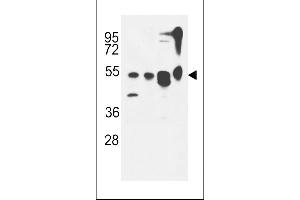 ATG13 Antibody (N-term) (ABIN653882 and ABIN2843129) western blot analysis in MDA-M,CEM,T47D cell line and mouse cerebellum tissue lysates (35 μg/lane). (ATG13 antibody  (N-Term))