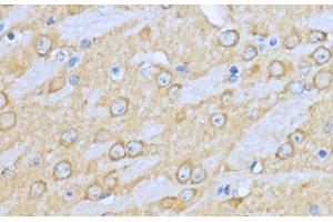 Immunohistochemistry (Paraffin-embedded Sections) (IHC (p)) image for anti-Heat Shock Protein 90kDa alpha (Cytosolic), Class A Member 1 (HSP90AA1) antibody (ABIN7256124)