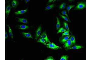 Immunofluorescent analysis of Hela cells using ABIN7160129 at dilution of 1:100 and Alexa Fluor 488-congugated AffiniPure Goat Anti-Rabbit IgG(H+L) (MFSD5 antibody  (AA 216-248))