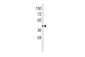 Western blot analysis of HLA-E Antibody (Center) (ABIN652456 and ABIN2842310) in MDA-M cell line lysates (35 μg/lane). (HLA-E antibody  (AA 108-135))