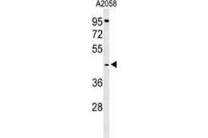 Western blot analysis of GPSN2 (arrow) in A2058 cell line lysates (35ug/lane) using TECR / GPSN2  (TECR antibody  (C-Term))