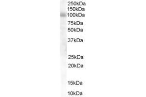 HPS6 antibody  (Internal Region)