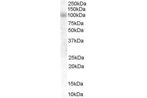 HPS6 antibody  (Internal Region)